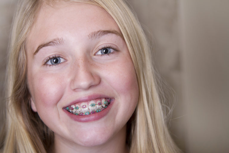 Children and Teen Orthodontics Coast Family Dental Currimundi