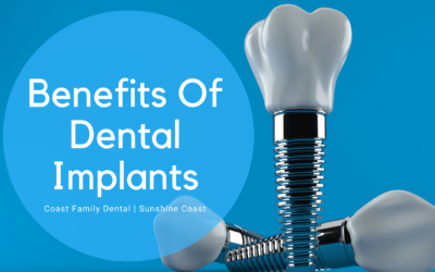 Benefits of Dental Implants for Sunshine Coast QLD Residents