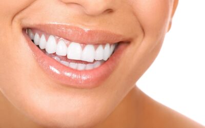 3 Great Reasons For Teeth Whitening