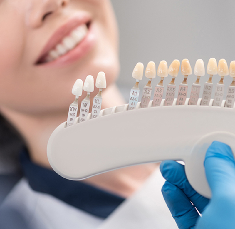 Veneers-img Coast Family Dental