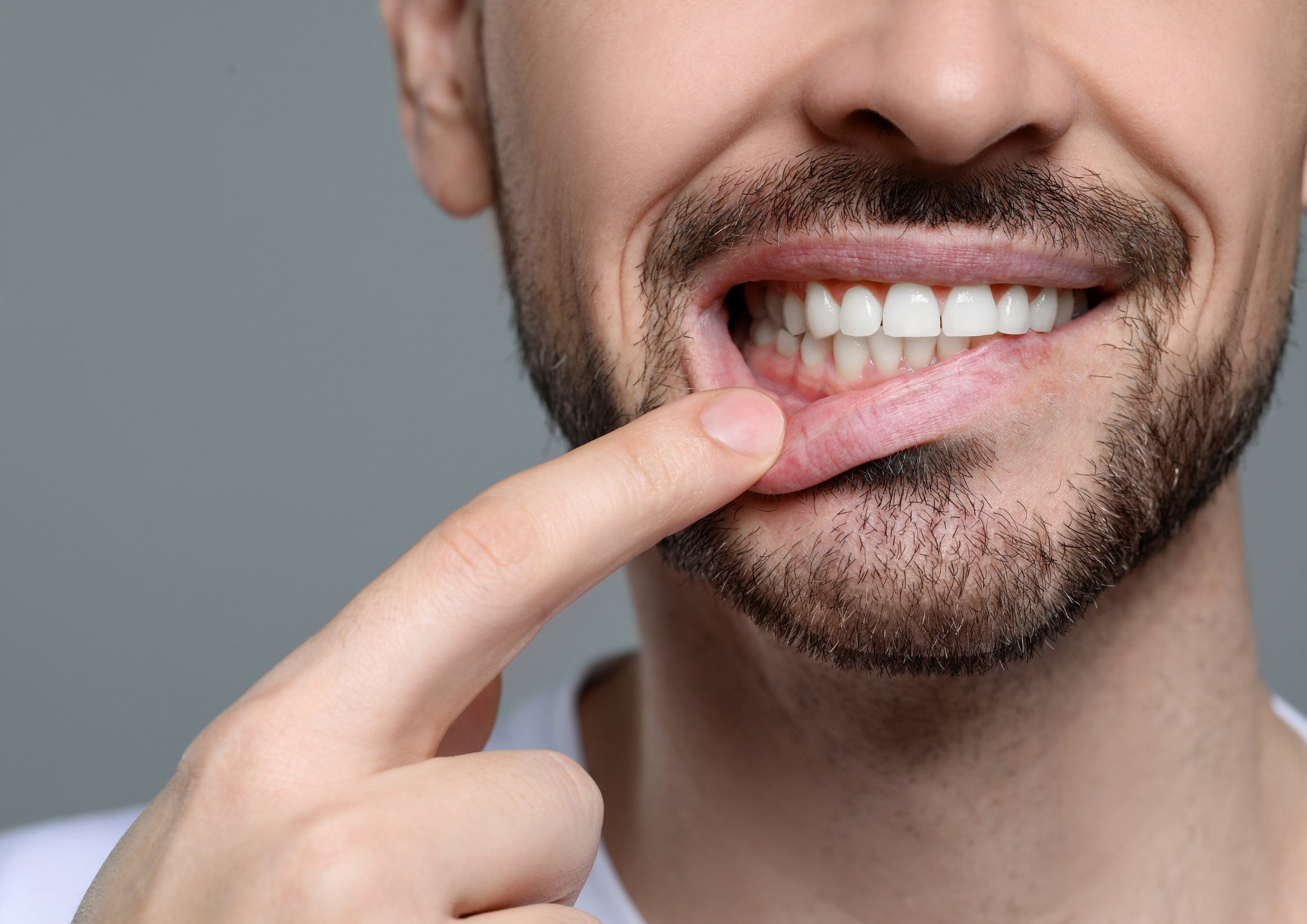 How To Keep Your Gums Healthy