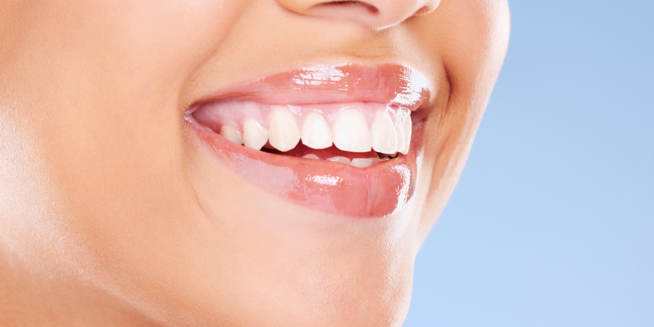 Coast-Family-Dental_Teeth-Whitening Teeth Whitening Sunshine Coast | Coast Family Dental