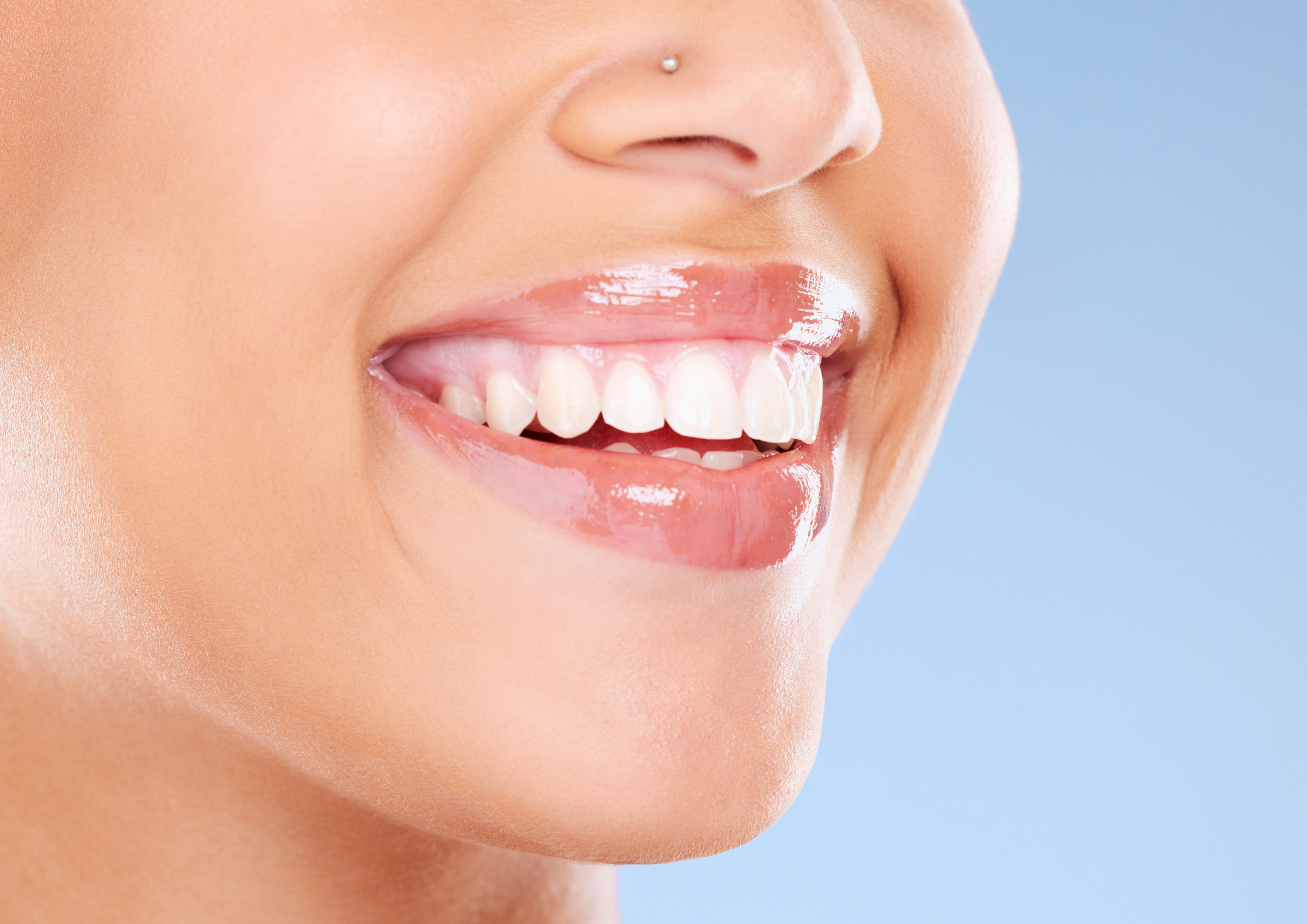 Teeth Whitening Sunshine Coast | Coast Family Dental