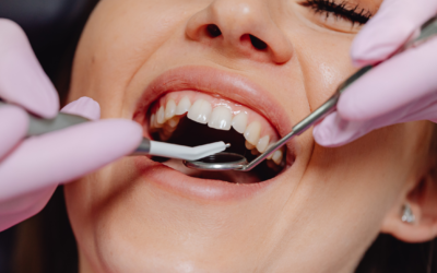 All About Dental Crowns: When Do You Need One?