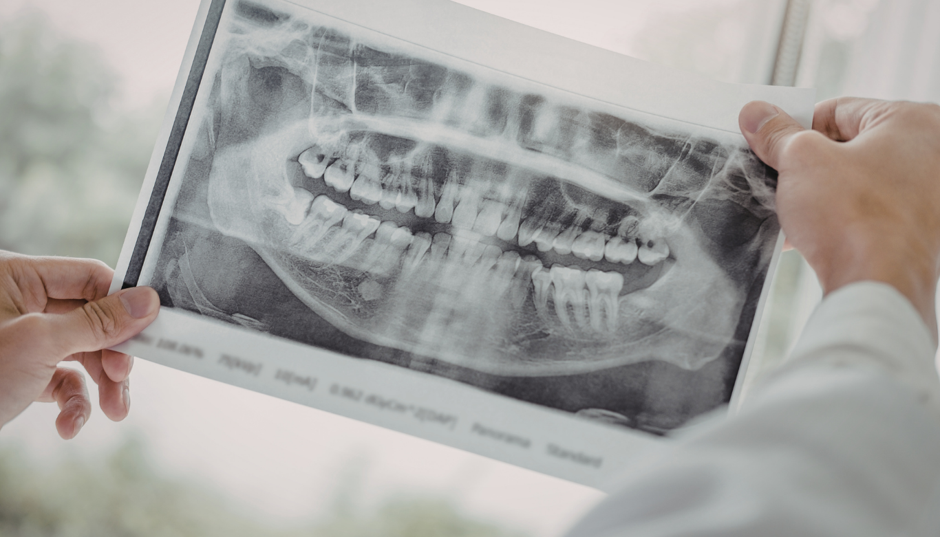 cf-dental-radiographs